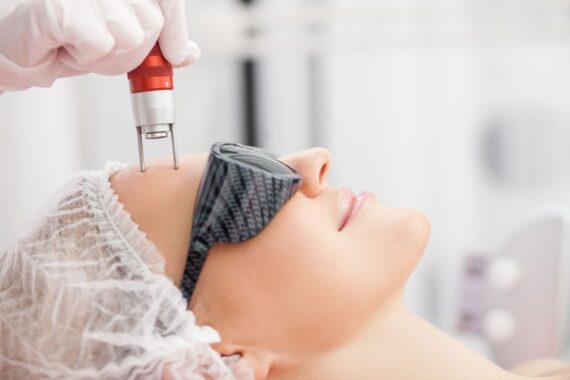 How Dermal Optical Thermolysis (DOT) Therapy Can Help Your Skin This Winter