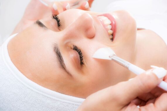 Why Chemical Peels Are Safe and Recommended in the Winter