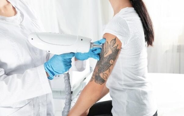 Tattoo Removal Before Swimsuit Season