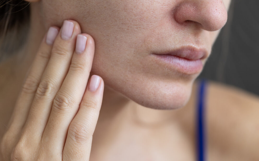 Sanitizers and Cleaning Products May Be Causing Your Itchy, Dry Skin